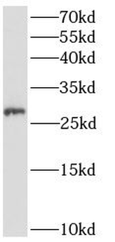 ANKRD49 Antibody