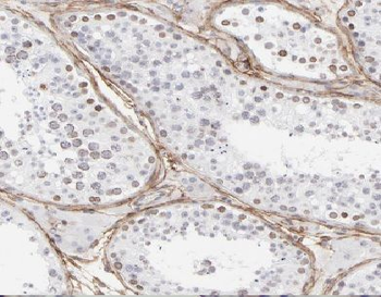 ANKS1B Antibody