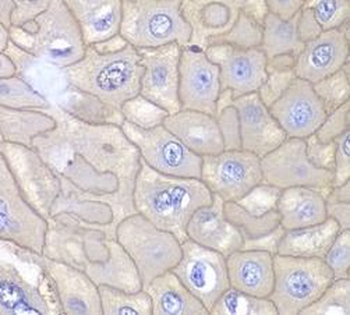 ANXA1 Antibody