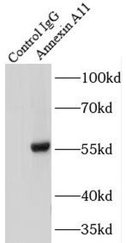 ANXA11 Antibody