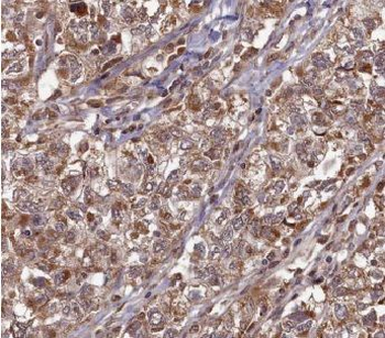 ANXA11 Antibody