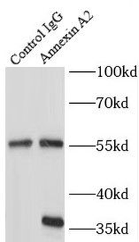 ANXA2 Antibody