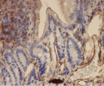 ANXA3 Antibody
