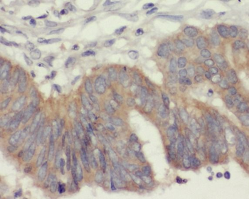 ANXA6 Antibody