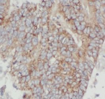 ANXA7 Antibody