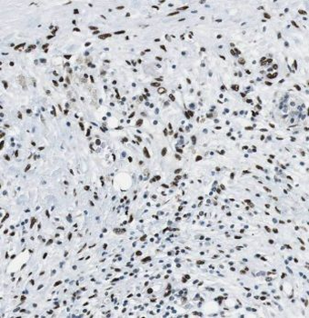 ANP32B Antibody
