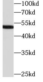 SERPINC1 Mouse Monoclonal Antibody