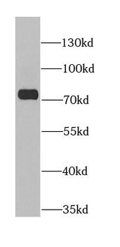 ANTXR2 Antibody