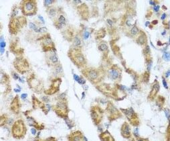 ANTXR2 Antibody