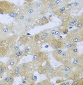 AP1M2 Antibody