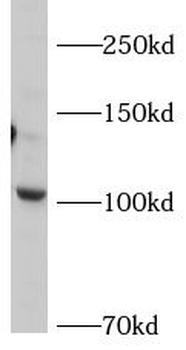 AP2A2 Antibody