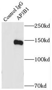 AP3B1 Antibody