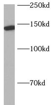 AP3B1 Antibody