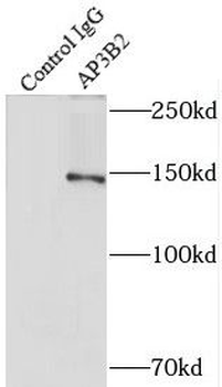 AP3B2 Antibody