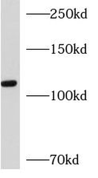 AP3D1 Antibody