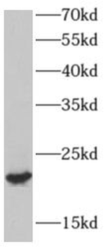 AP3S2 Antibody