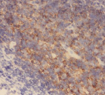 AP4M1 Antibody