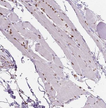 ANAPC11 Antibody