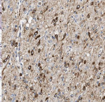 ANAPC2 Antibody