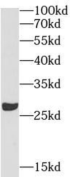 APOA1 Mouse Monoclonal Antibody