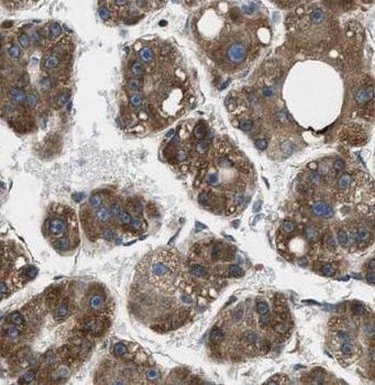 APOA1 Mouse Monoclonal Antibody