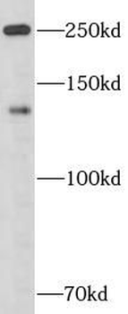 APOB Antibody