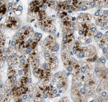 APOB Antibody