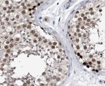 APOBEC3G Antibody