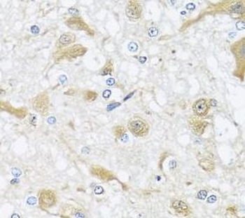 APOL1 Antibody