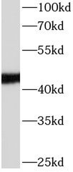 APOL1 Mouse Monoclonal Antibody