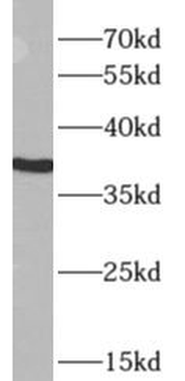 APOL2 Antibody