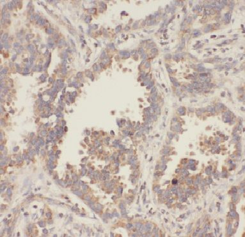 APOL2 Antibody