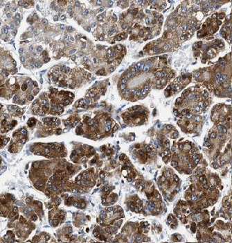 APOA1 Antibody