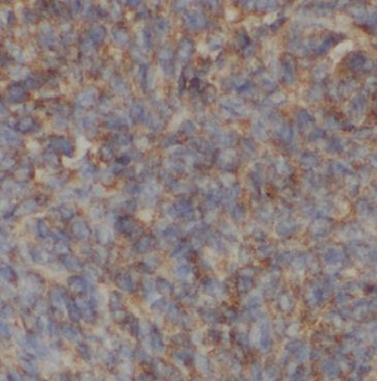 APOH Antibody