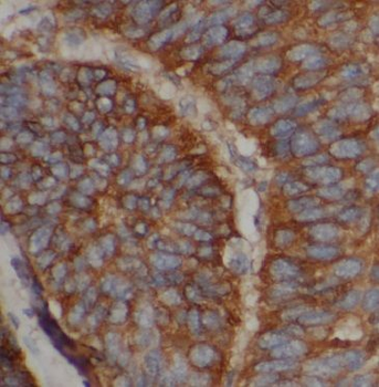 APOM Antibody