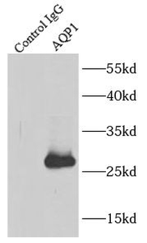 AQP1 Antibody