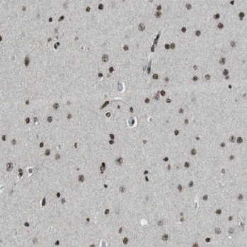 AQR Antibody