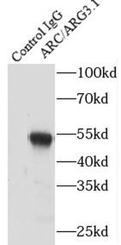 ARC Rabbit Polyclonal Antibody