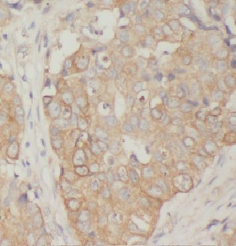 ARF1 Antibody