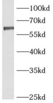 ARFGAP2 Antibody