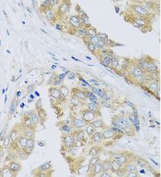 ARFGAP3 Antibody