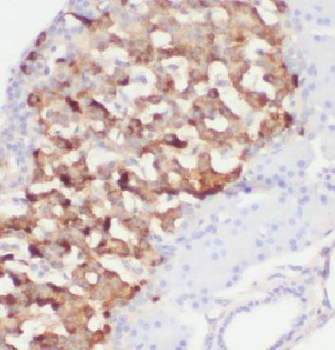 ARFIP1 Antibody