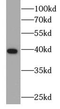 ARG2 Antibody