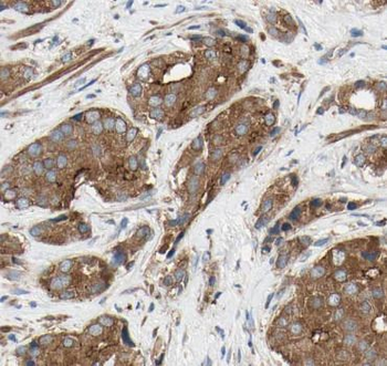 ARG2 Antibody