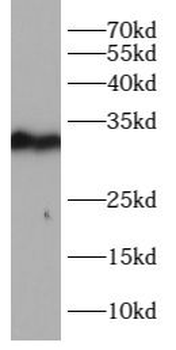 LDLRAP1 Rabbit Polyclonal Antibody