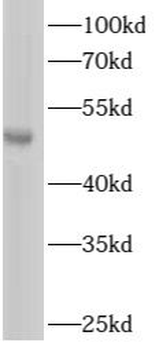 ARHGAP1 Antibody