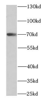 ARHGAP25 Antibody