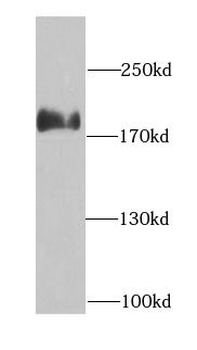 ARHGAP5 Antibody