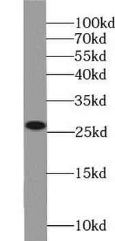 ARHGDIB Antibody