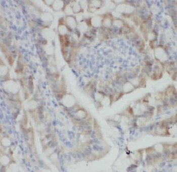 ARHGEF1 Antibody